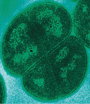 Illustration for article titled Extremophiles I Have Known And Loved